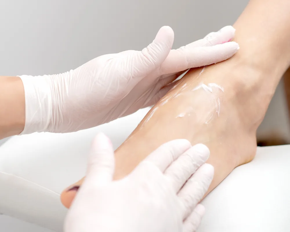 Mavex Callus Peel